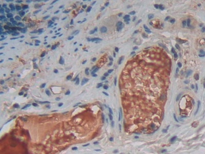 Polyclonal Antibody to Tumor Necrosis Factor Ligand Superfamily, Member 14 (TNFSF14)