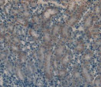 Polyclonal Antibody to Follicle Stimulating Hormone (FSH)