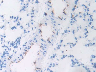 Polyclonal Antibody to Von Willebrand Factor (vWF)