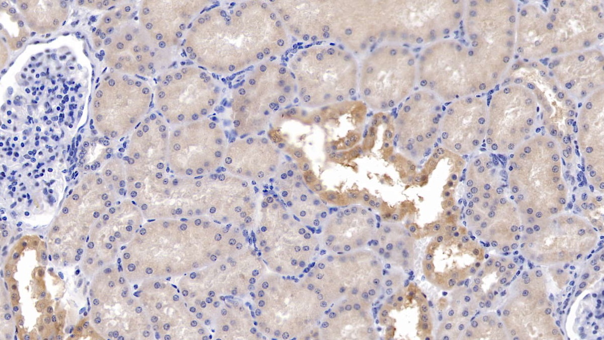 Polyclonal Antibody to Corticotropin Releasing Factor (CRF)