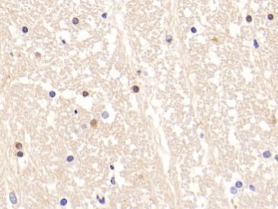 Polyclonal Antibody to Adrenocorticotropic Hormone (ACTH)