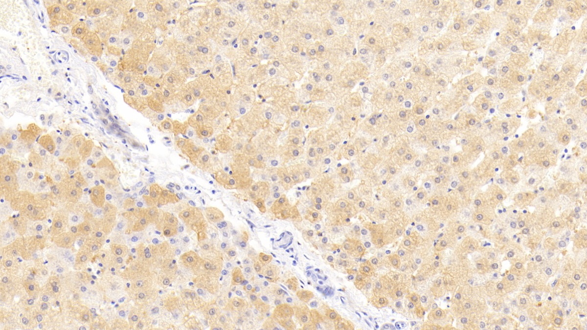 Polyclonal Antibody to Nitric Oxide Synthase 2, Inducible (NOS2)