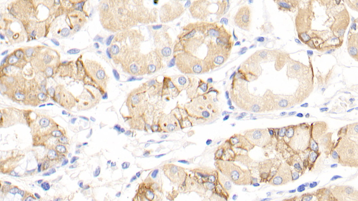 Polyclonal Antibody to Inhibin Beta A (INHbA)