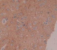 Polyclonal Antibody to Coagulation Factor IX (F9)
