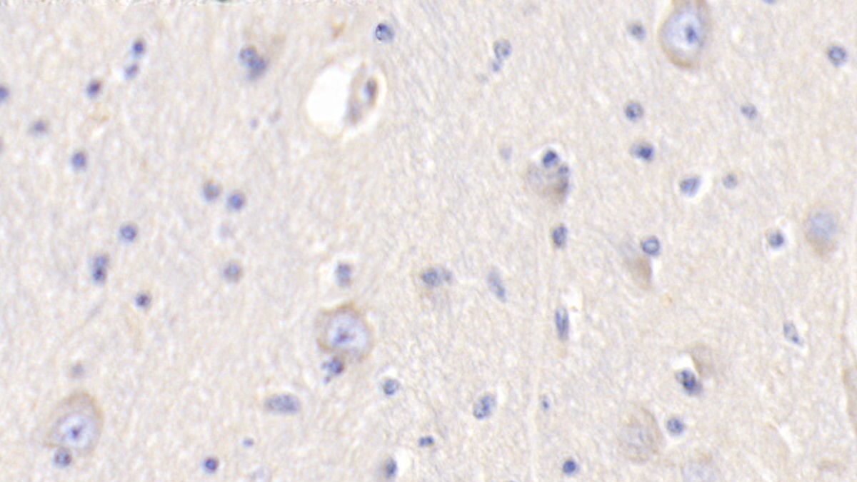 Polyclonal Antibody to Resistin (RETN)