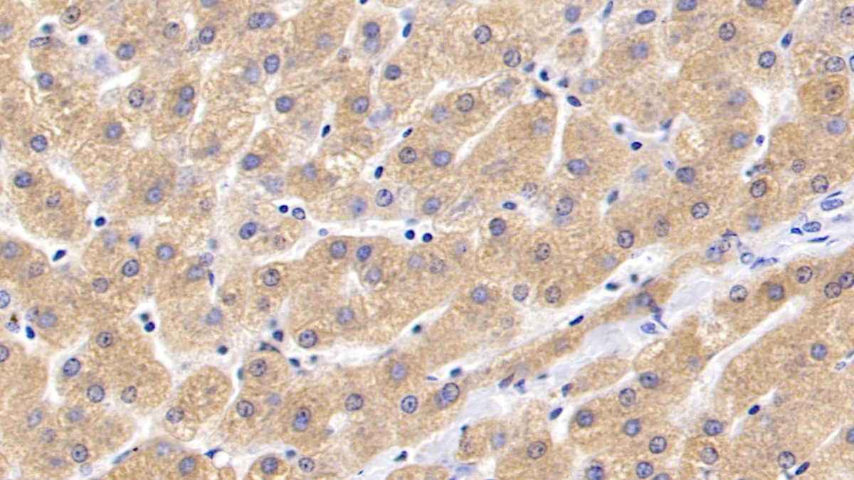 Polyclonal Antibody to Glycogen Phosphorylase, Liver (PYGL)