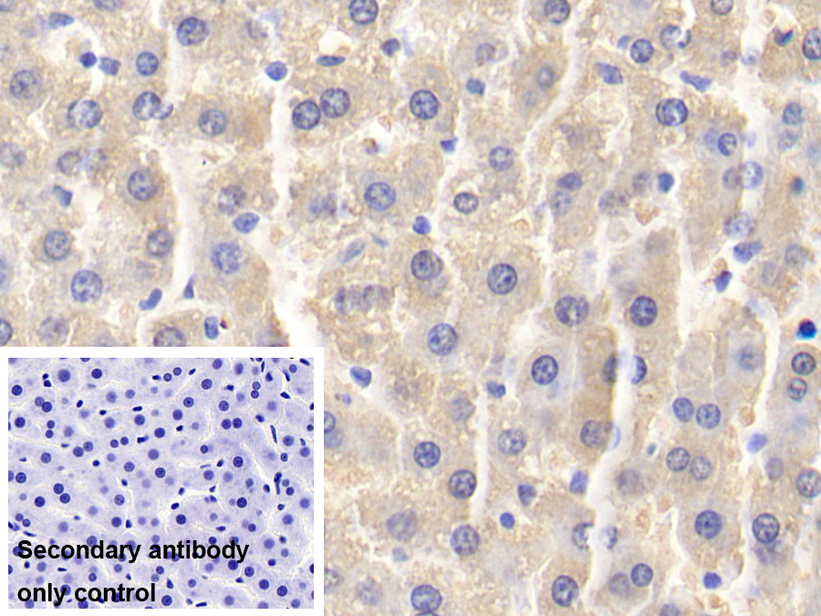 Polyclonal Antibody to Glycogen Phosphorylase, Liver (PYGL)