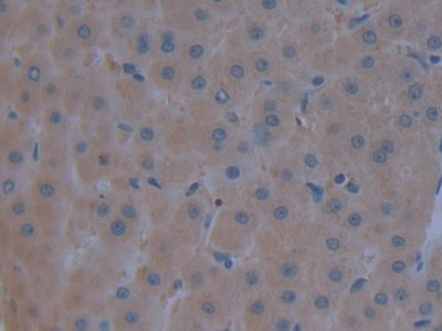 Polyclonal Antibody to Complement Component 3 (C3)