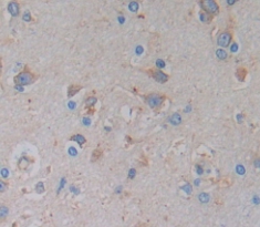 Polyclonal Antibody to Parathyroid Hormone (PTH)