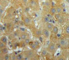 Polyclonal Antibody to Parathyroid Hormone (PTH)