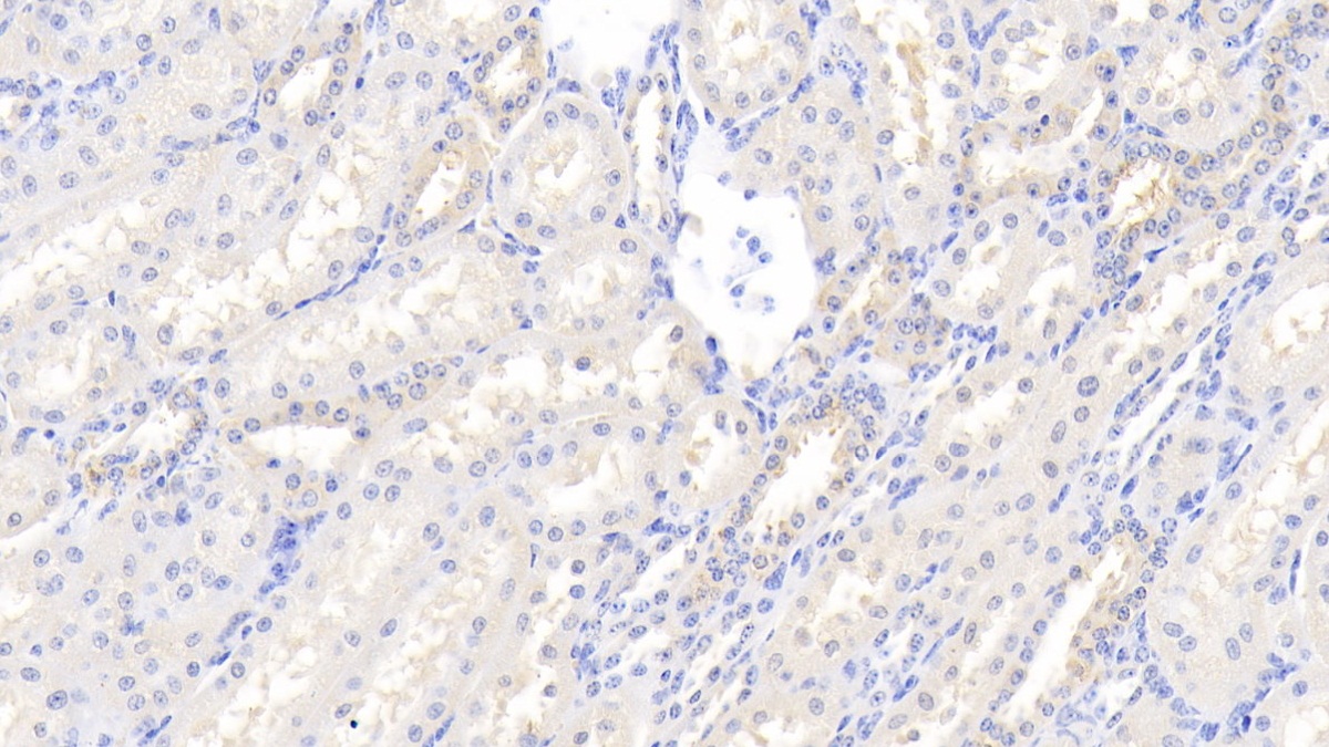 Polyclonal Antibody to Endothelial NOS (eNOS)