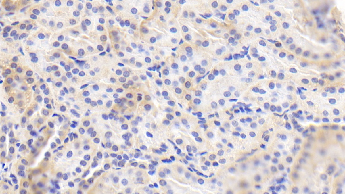 Polyclonal Antibody to Endothelial NOS (eNOS)