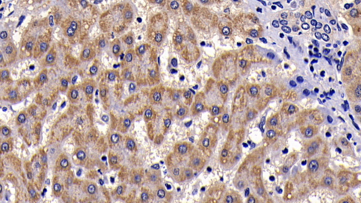 Polyclonal Antibody to Serum Amyloid A (SAA)