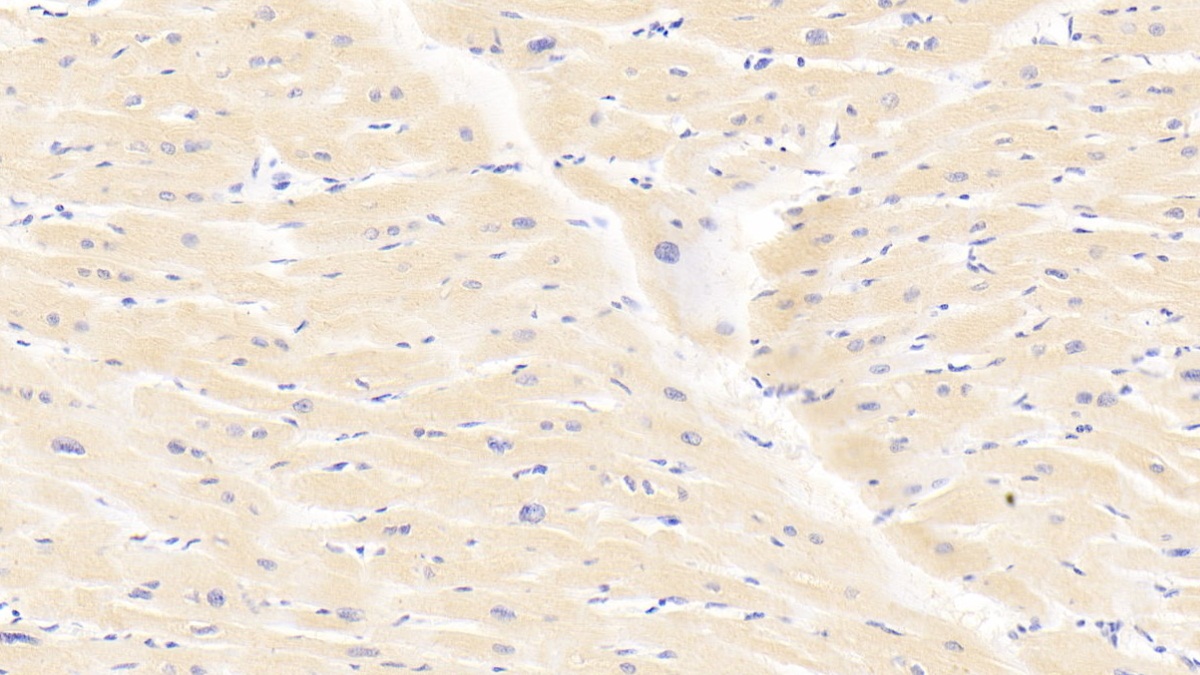 Polyclonal Antibody to Pyruvate Dehydrogenase Phosphatase (PDP)