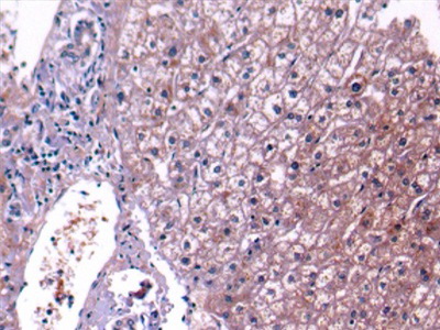 Polyclonal Antibody to Complement Component 4 (C4)