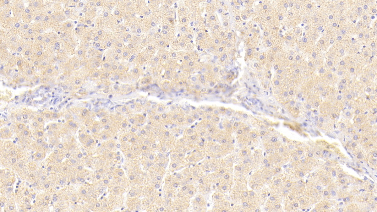 Polyclonal Antibody to Insulin Receptor (INSR)