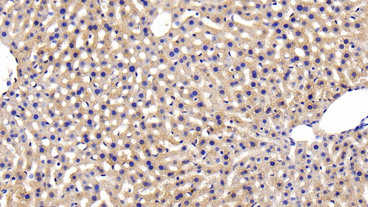 Polyclonal Antibody to Insulin Receptor (INSR)