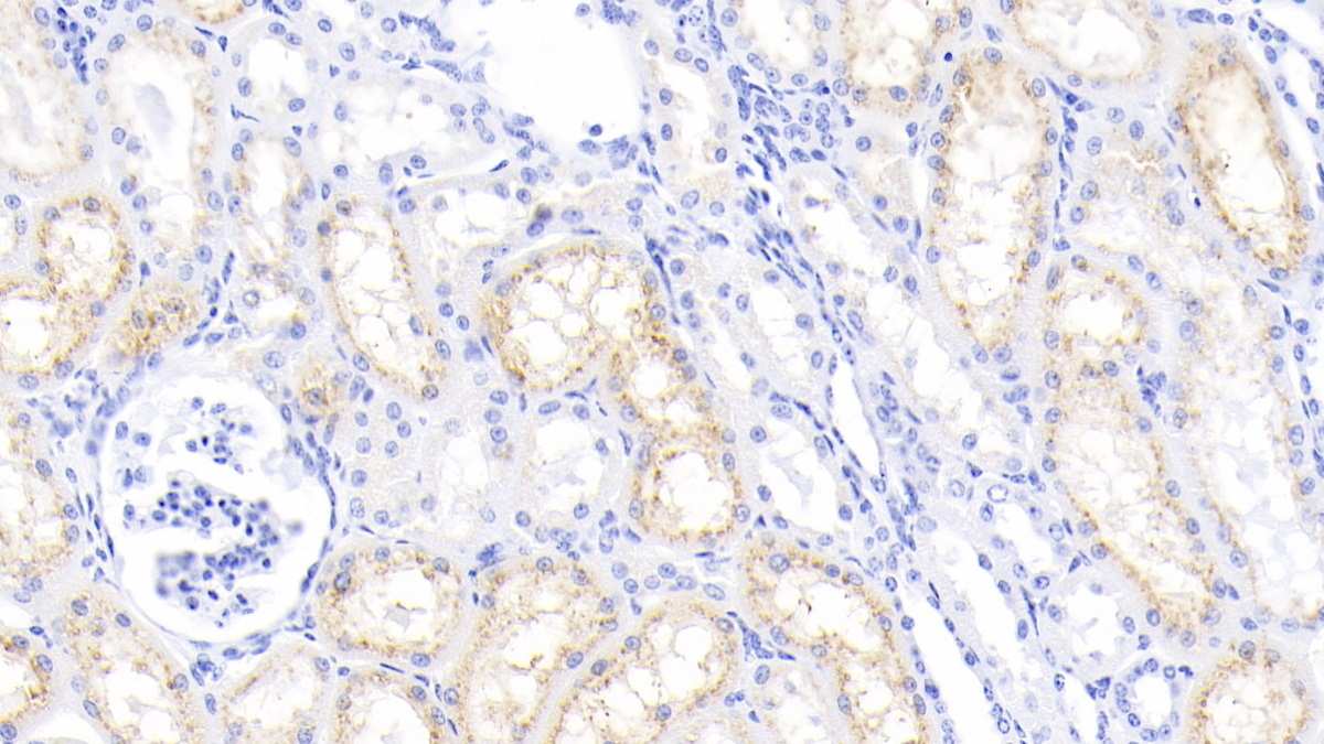 Polyclonal Antibody to Cystatin C (Cys-C)