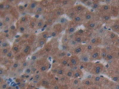 Polyclonal Antibody to Cystatin C (Cys-C)