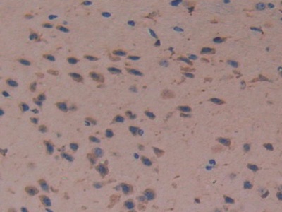 Polyclonal Antibody to Cystatin C (Cys-C)