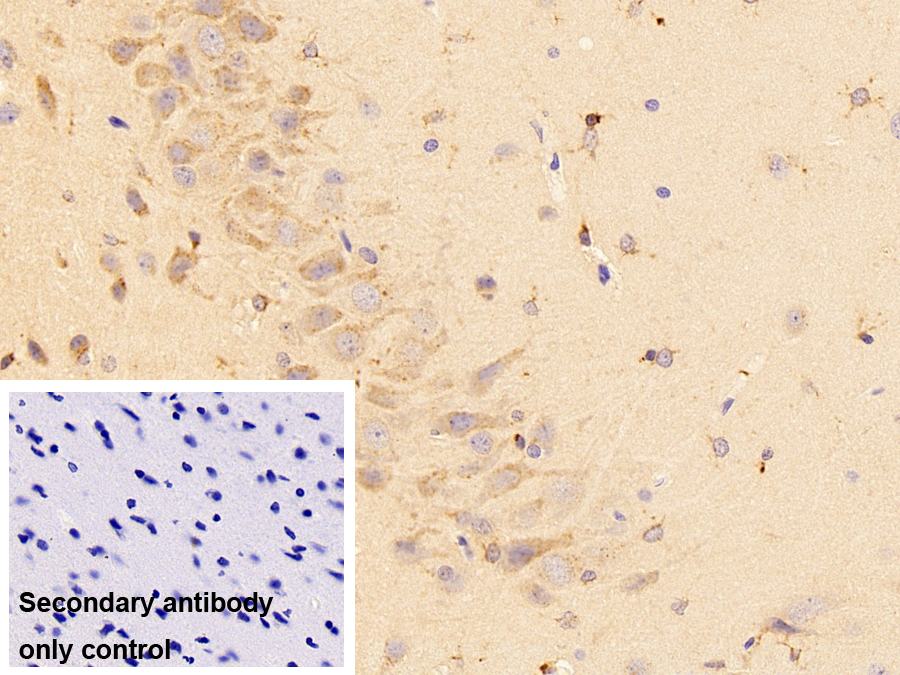 Polyclonal Antibody to Cystatin C (Cys-C)