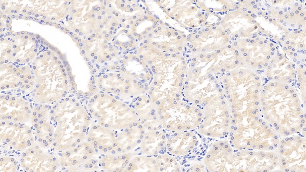 Polyclonal Antibody to Osteopontin (OPN)