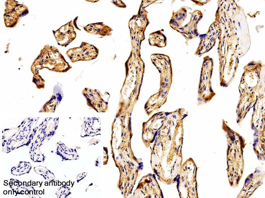 Polyclonal Antibody to Ceruloplasmin (CP)