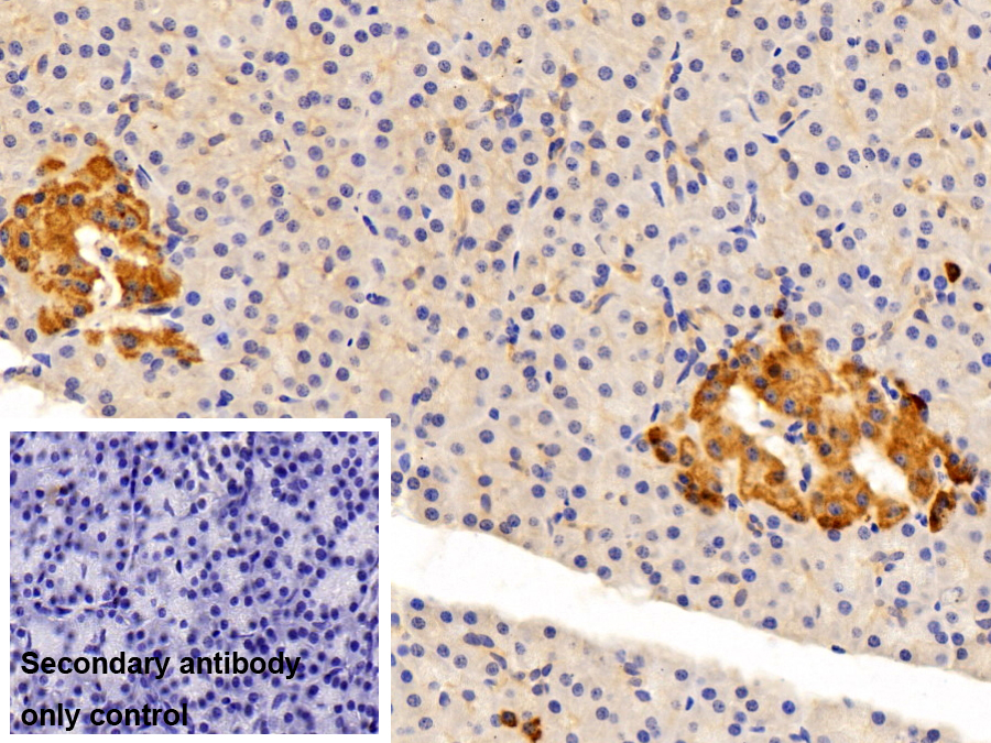 Polyclonal Antibody to Retinol Binding Protein 4 (RBP4)