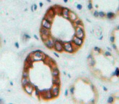 Polyclonal Antibody to Nephrin (NPHN)