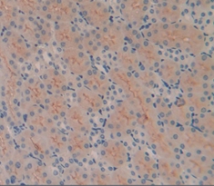 Polyclonal Antibody to Podocin (PDCN)