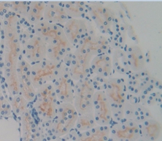 Polyclonal Antibody to Podocin (PDCN)