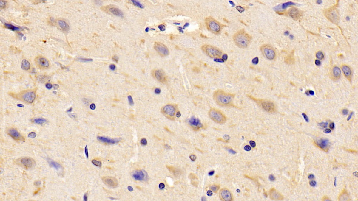 Polyclonal Antibody to Chemerin (CHEM)