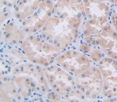 Polyclonal Antibody to L1-Cell Adhesion Molecule (L1CAM)