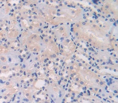 Polyclonal Antibody to L1-Cell Adhesion Molecule (L1CAM)