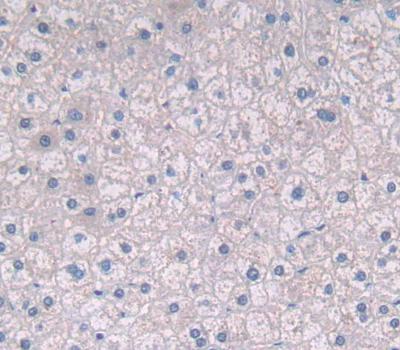 Polyclonal Antibody to ATP Binding Cassette Transporter G2 (ABCG2)