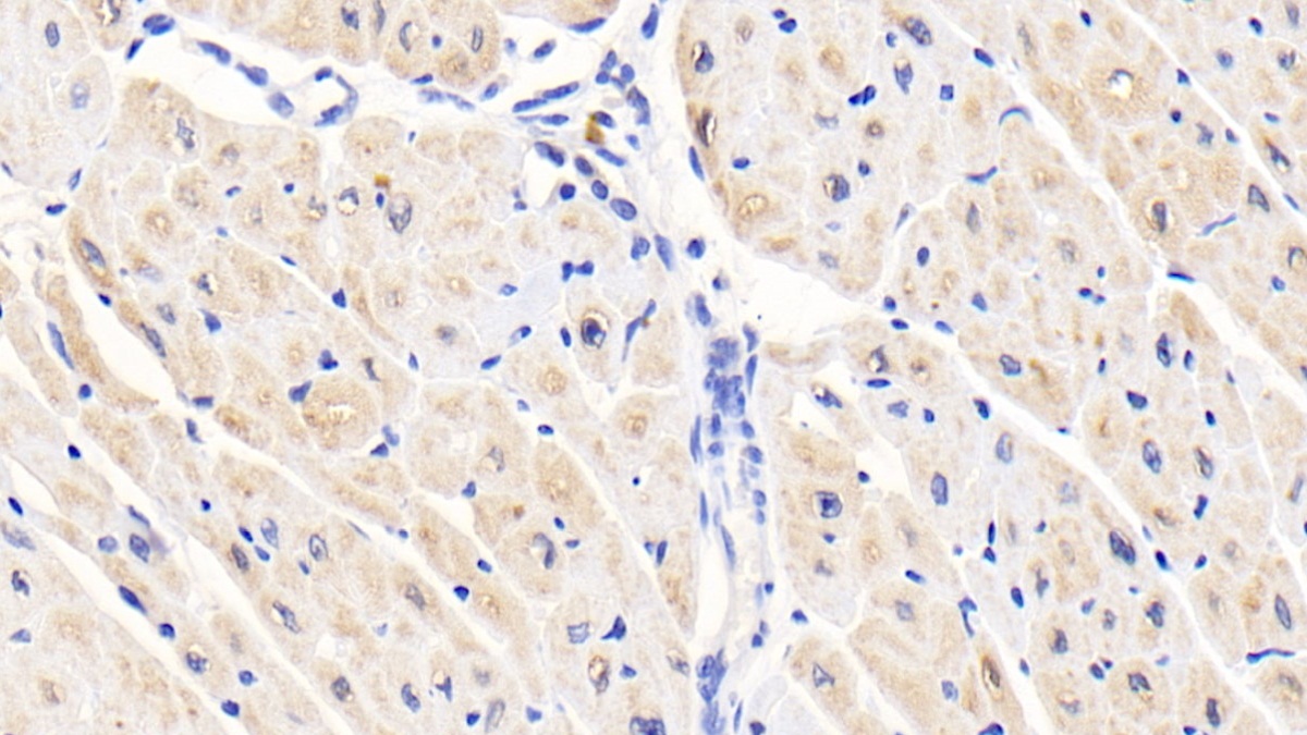 Polyclonal Antibody to Activin A Receptor Type I (ACVR1)