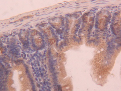 Polyclonal Antibody to Activin A Receptor Type I (ACVR1)