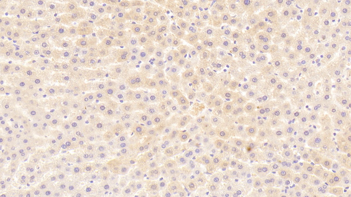 Polyclonal Antibody to Cholinergic Receptor, Nicotinic, Alpha 1 (CHRNa1)