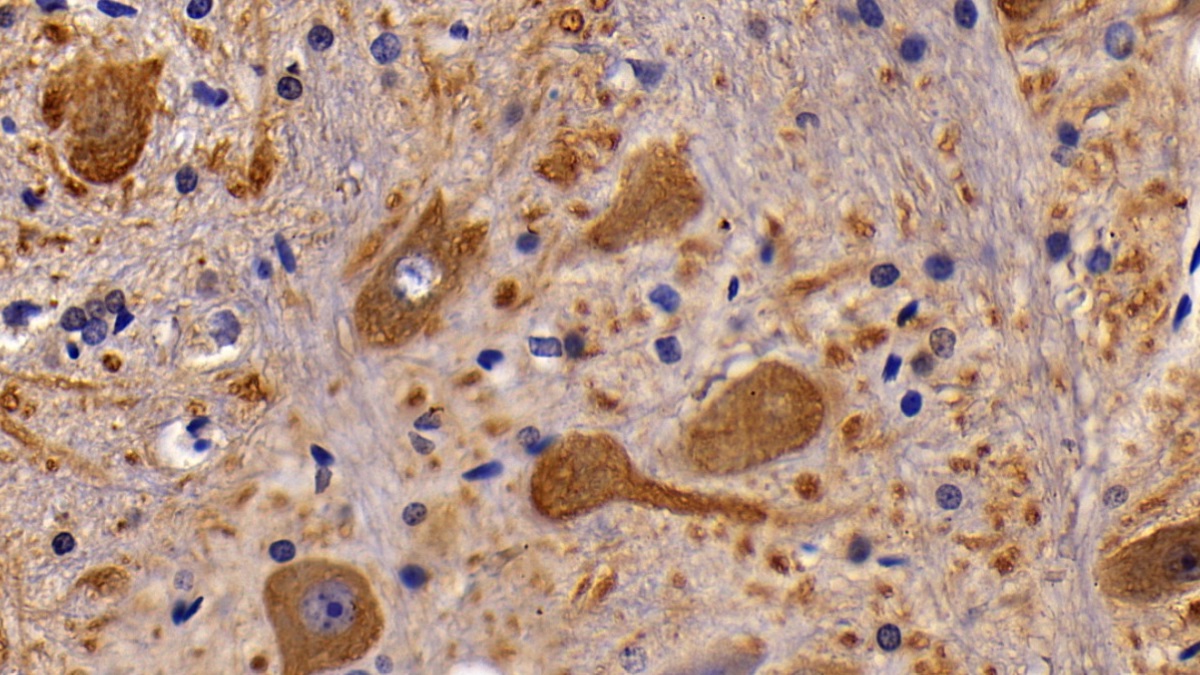 Polyclonal Antibody to Cholinergic Receptor, Muscarinic 1 (CHRM1)