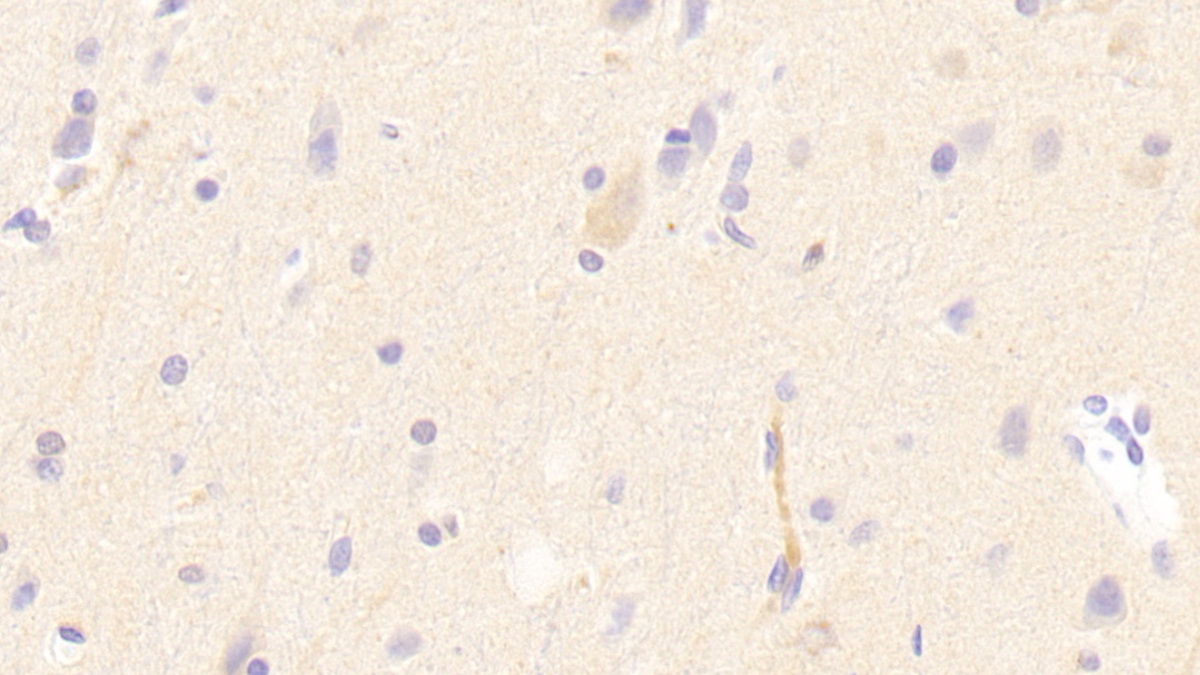 Polyclonal Antibody to Low Density Lipoprotein Receptor (LDLR)