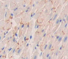 Polyclonal Antibody to Placental Cadherin (P-cadherin)