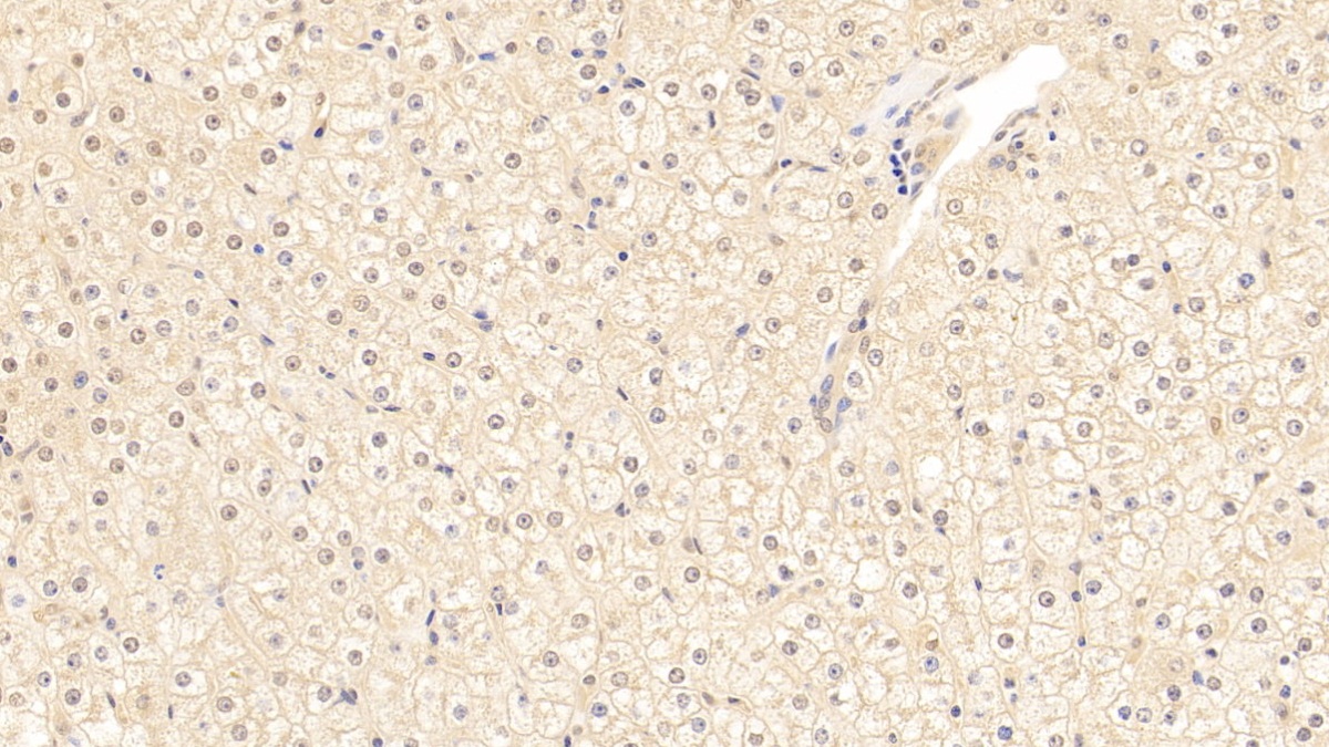 Polyclonal Antibody to Alpha-1-Antichymotrypsin (a1ACT)