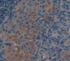 Polyclonal Antibody to Alpha-Lactalbumin (aLA)