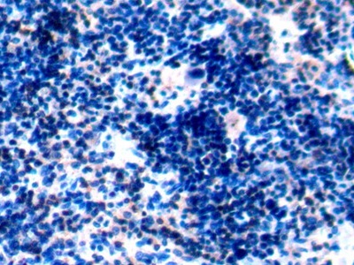 Polyclonal Antibody to Protein Tyrosine Phosphatase Receptor Type C (CD45)