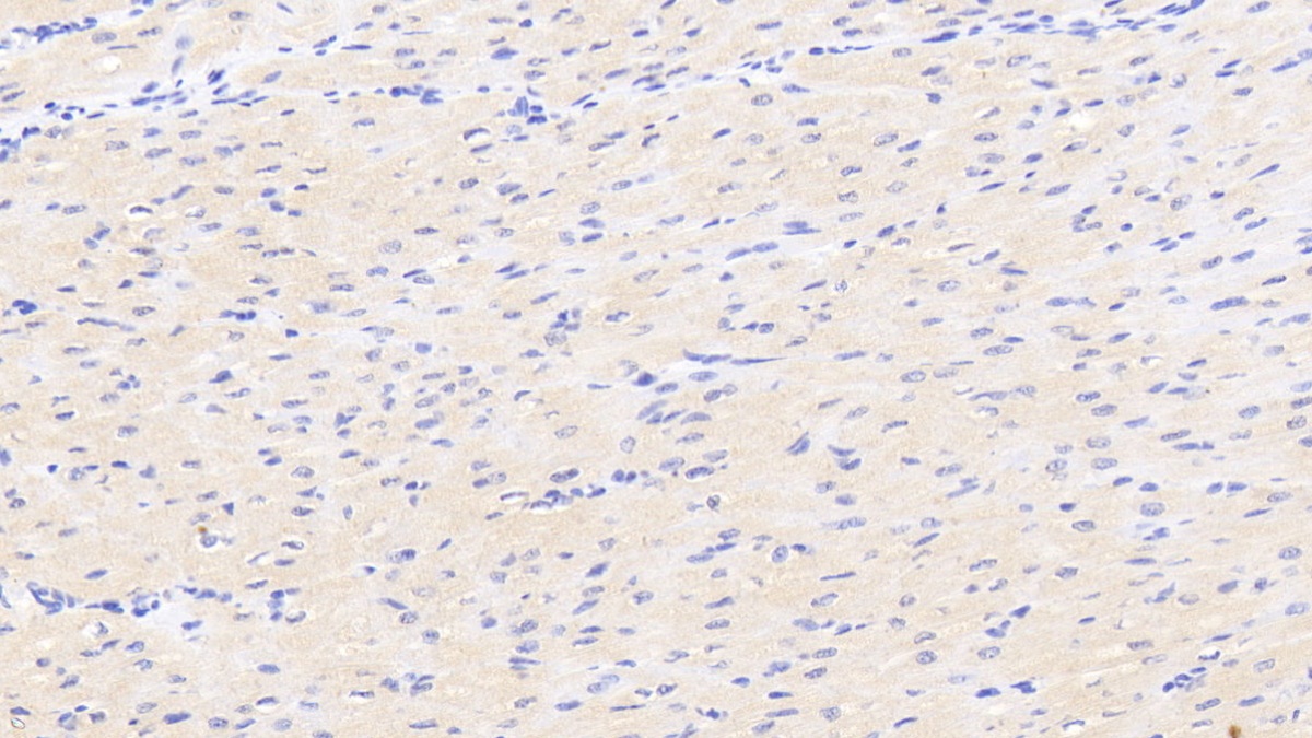 Polyclonal Antibody to Dickkopf Related Protein 2 (DKK2)