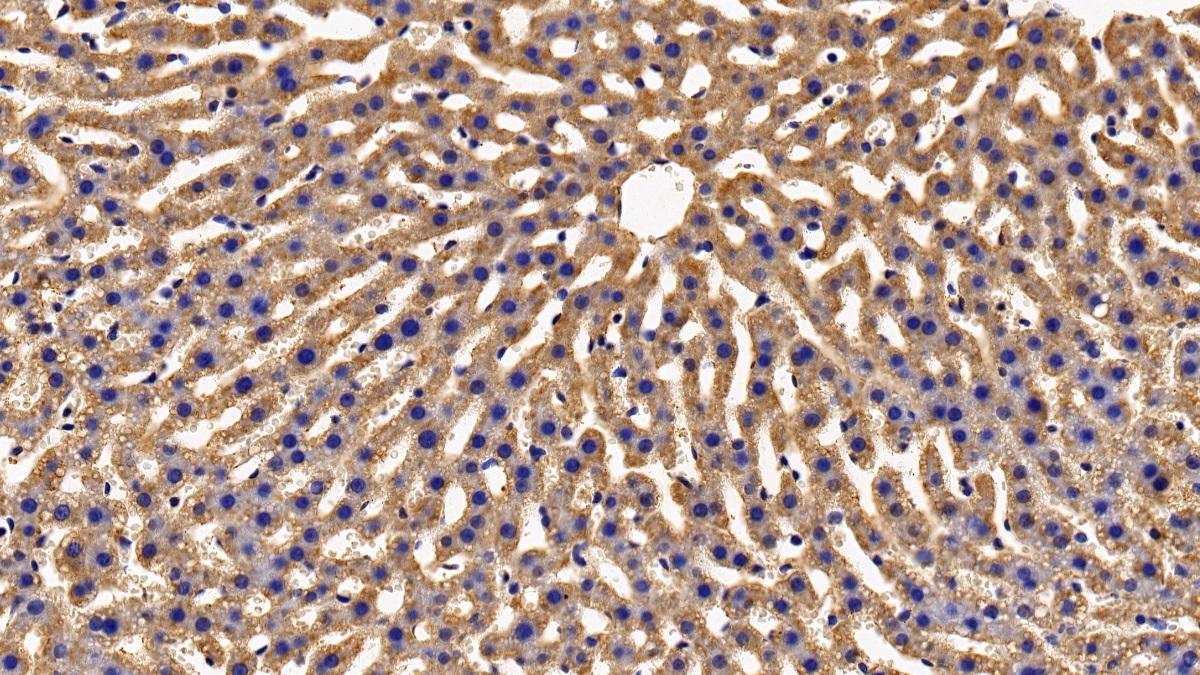 Polyclonal Antibody to Growth Hormone Receptor (GHR)