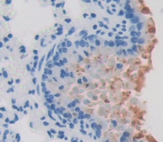 Polyclonal Antibody to Surfactant Associated Protein D (SPD)
