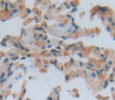 Polyclonal Antibody to Vitronectin (VTN)