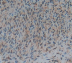 Polyclonal Antibody to Estrogen Receptor Alpha (ERa)