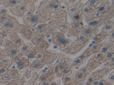 Polyclonal Antibody to Apoptotic Peptidase Activating Factor 1 (APAF1)